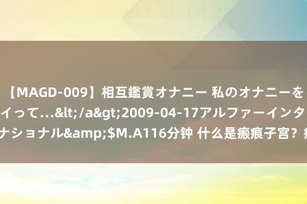 【MAGD-009】相互鑑賞オナニー 私のオナニーを見ながら、あなたもイって…</a>2009-04-17アルファーインターナショナル&$M.A116分钟 什么是瘢痕子宫？瘢痕子宫再次妊娠有哪些风险？